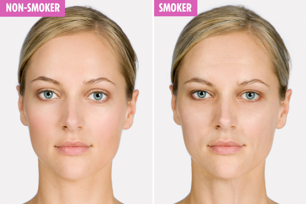 ageing symptoms in smokers vs non-smokers