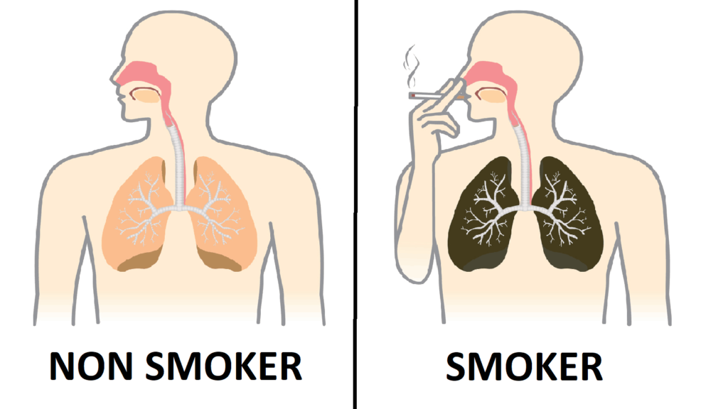 smokers vs non-smokers